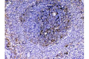 IHC analysis of VCAM1 using anti-VCAM1 antibody . (VCAM1 antibody  (AA 25-270))