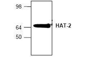 Image no. 1 for anti-MYST Histone Acetyltransferase 2 (MYST2) (N-Term) antibody (ABIN155154)