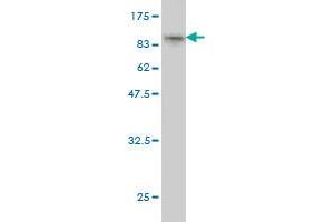 Western Blot detection against Immunogen (95. (RPAP3 antibody  (AA 1-631))