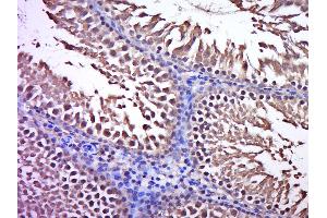 Paraformaldehyde-fixed, paraffin embedded rat testis, Antigen retrieval by boiling in sodium citrate buffer (pH6. (SSUH2 antibody  (AA 51-150))