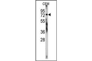 Image no. 1 for anti-Zinc Finger Protein 219 (ZNF219) (AA 660-690), (C-Term) antibody (ABIN357353)