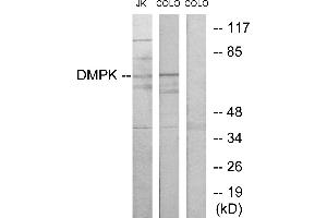 Western blot analysis of extracts from Jurkat cells and COLO205 cells, using DMPK antibody. (DMPK antibody)