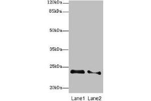 Western blot All lanes: RRAS2 antibody at 2. (RRAS2 antibody  (AA 1-204))