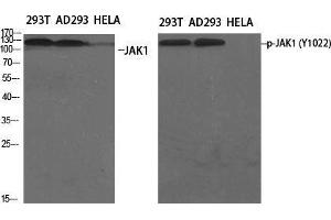 Western Blot (WB) analysis of specific cells using Phospho-JAK1 (Y1022) Polyclonal Antibody.