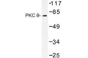 Image no. 1 for anti-Protein Kinase C, theta (PRKCQ) antibody (ABIN317883) (PKC theta antibody)