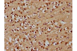 IHC image of ABIN7167791 diluted at 1:300 and staining in paraffin-embedded human brain tissue performed on a Leica BondTM system. (p130 antibody  (AA 417-616))