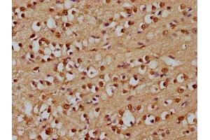 IHC image of ABIN7167791 diluted at 1:300 and staining in paraffin-embedded human brain tissue performed on a Leica BondTM system. (p130 antibody  (AA 417-616))
