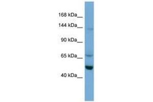 TRIM66 anticorps  (AA 359-408)