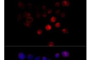 Immunofluorescence analysis of 293T cells using TOM1 Polyclonal Antibody at dilution of 1:100 (40x lens). (TOM1 antibody)