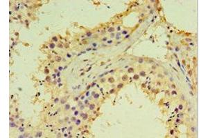 Immunohistochemistry of paraffin-embedded human testis tissue using ABIN7144984 at dilution of 1:100 (DDX39 antibody  (AA 178-427))