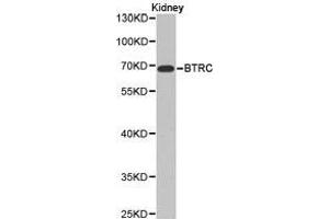 Western Blotting (WB) image for anti-beta-Transducin Repeat Containing (BTRC) antibody (ABIN1871369)