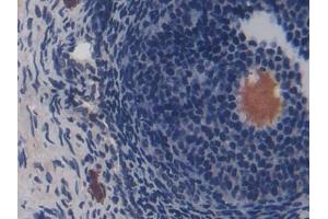DAB staining on IHC-P; Samples: Rat Ovary Tissue (CD8B antibody  (AA 21-208))