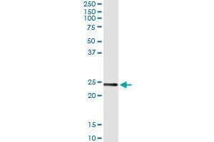 Immunoprecipitation of UBE2T transfected lysate using anti-UBE2T monoclonal antibody and Protein A Magnetic Bead , and immunoblotted with UBE2T MaxPab rabbit polyclonal antibody. (Ube2t antibody  (AA 1-197))