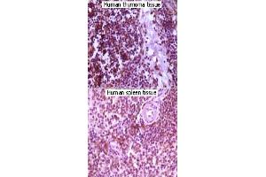Immunohistochemical analysis of paraffin-embedded lymphocyte of human thymoma and human spleen tissue showing cytoplasmic localization using MAP2K4 monoclonal antibody, clone 2D10D8,4G11B2  with DAB staining. (MAP2K4 antibody)
