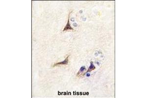 Formalin-fixed and paraffin-embedded human brain tissue reacted with NGFB antibody (Center) (ABIN392194 and ABIN2841899) , which was peroxidase-conjugated to the secondary antibody, followed by DAB staining. (NGFB antibody  (AA 84-115))