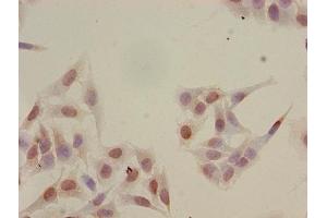 Immunocytochemistry analysis of Hela cells using ABIN7139165 at dilution of 1:100 (HIST1H2BB antibody  (acLys16))