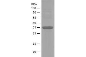ITGAL Protein (AA 1112-1170) (His-IF2DI Tag)