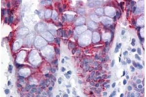 Human Colon: Formalin-Fixed, Paraffin-Embedded (FFPE) (EPSTI1 antibody  (AA 1-101))