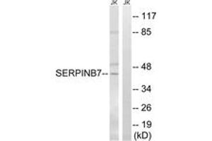 Western blot analysis of extracts from Jurkat cells, using SERPINB7 Antibody. (SERPINB7 antibody  (AA 111-160))