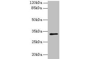 Western blot All lanes: PLPP2 antibody at 8 μg/mL + MCF-7 whole cell lysate Secondary Goat polyclonal to rabbit IgG at 1/10000 dilution Predicted band size: 33, 35, 27 kDa Observed band size: 33 kDa (PPAP2C antibody  (AA 109-162))