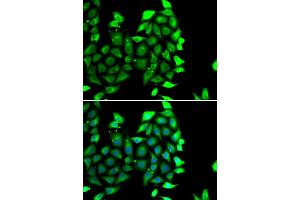 Immunofluorescence analysis of MCF-7 cells using IKZF3 antibody (ABIN4904027). (IKZF3 antibody)