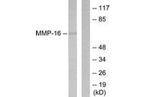 Western blot analysis of extracts from HepG2 cells, using MMP-16 Antibody. (MMP16 antibody  (AA 551-600))