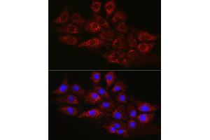 Immunofluorescence analysis of NIH/3T3 cells using CPT2 Rabbit pAb (ABIN6129249, ABIN6138983, ABIN6138984 and ABIN6216045) at dilution of 1:100 (40x lens). (CPT2 antibody  (AA 1-180))