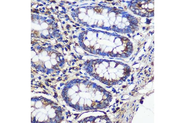 SND1 antibody  (AA 26-285)