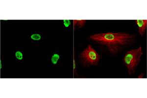 ICC/IF Image KAP1 antibody [N3C2], Internal detects KAP1 protein at nucleus by immunofluorescent analysis. (KAP1 antibody)