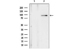 anti-Anoctamin 1, Calcium Activated Chloride Channel (ANO1) (Internal Region) antibody