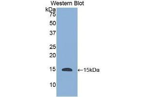 Detection of Recombinant HTN1, Human using Polyclonal Antibody to Histatin 1 (HTN1) (HTN1 antibody  (AA 20-57))