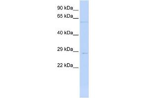 WB Suggested Anti-MRPL10 Antibody Titration: 0. (MRPL10 antibody  (N-Term))