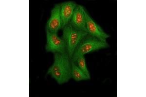 IF analysis of SSRP1 using anti-SSRP1 antibody (ABIN7600496) and anti-Tubulin Alpha antibody (ABIN7600339). (SSRP1 antibody  (AA 2-381))