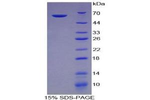SDS-PAGE (SDS) image for Integrin, alpha 5 (ITGA5) (AA 649-900) protein (His tag,GST tag) (ABIN2123029) (ITGA5 Protein (AA 649-900) (His tag,GST tag))