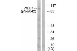 Western blot analysis of extracts from 293 cells treated with etoposide using WEE1 (Phospho-Ser642) Antibody. (WEE1 antibody  (pSer642))