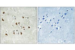 Immunohistochemistry (IHC) image for anti-Tubulin, gamma Complex Associated Protein 6 (TUBGCP6) (Internal Region) antibody (ABIN1851360) (GCP6 antibody  (Internal Region))