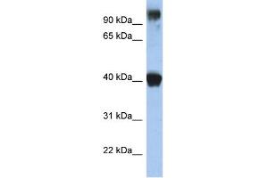 WB Suggested Anti-TFAP2E Antibody Titration:  0. (TFAP2E antibody  (N-Term))
