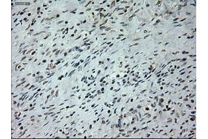 Immunohistochemical staining of paraffin-embedded colon tissue using anti-PROM2mouse monoclonal antibody. (Prominin 2 antibody)