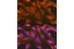 Immunofluorescence analysis of C6 cells using  antibody (ABIN7265552) at dilution of 1:100. (ALKBH1 antibody)