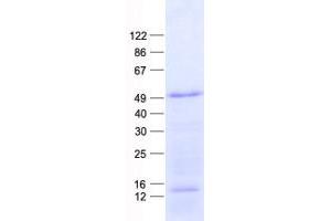 Western Blotting (WB) image for Neurogenic Differentiation 4 (NEUROD4) protein (His tag) (ABIN2727122)