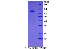 SDS-PAGE (SDS) image for Carboxypeptidase B1 (Tissue) (CPB1) (AA 111-417) protein (His tag) (ABIN2124228) (CPB1 Protein (AA 111-417) (His tag))
