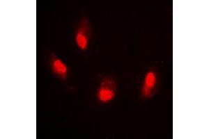 Immunofluorescent analysis of Histone H4 (AcK8) staining in HeLa cells. (Histone H4 antibody  (acLys8, N-Term))