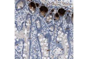Immunohistochemical staining of human duodenum with C3orf63 polyclonal antibody  shows strong positivity in Paneth and enteroendocrine cells.