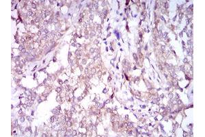 Immunohistochemistry (IHC) image for anti-Sequestosome 1 (SQSTM1) (AA 232-356) antibody (ABIN1724836)