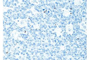 Immunohistochemistry (IHC) image for anti-Poly (ADP-Ribose) Polymerase 1 (PARP1) (AA 215-265) antibody (ABIN7455116) (Recombinant PARP1 antibody  (AA 215-265))