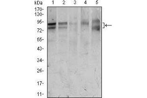 Western blot analysis using FOXP1 mouse mAb against HeLa (1), Jurkat (2), MCF-7 (3), T47D (4), and Raw264. (FOXP1 antibody  (AA 481-677))