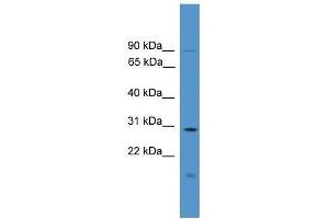 Western Blot showing RASSF1 antibody used at a concentration of 1. (RASSF1 antibody  (C-Term))