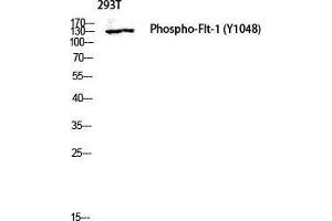 Western Blot (WB) analysis of 293T lysis using Phospho-Flt-1 (Y1048) antibody. (FLT1 antibody  (pTyr1048))
