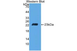 Western blot analysis of the recombinant protein. (CD6 antibody  (AA 30-204))