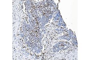 anti-SAM Domain and HD Domain 1 (SAMHD1) (AA 37-626) antibody
